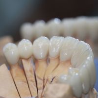 zirkoniové zubní korunky